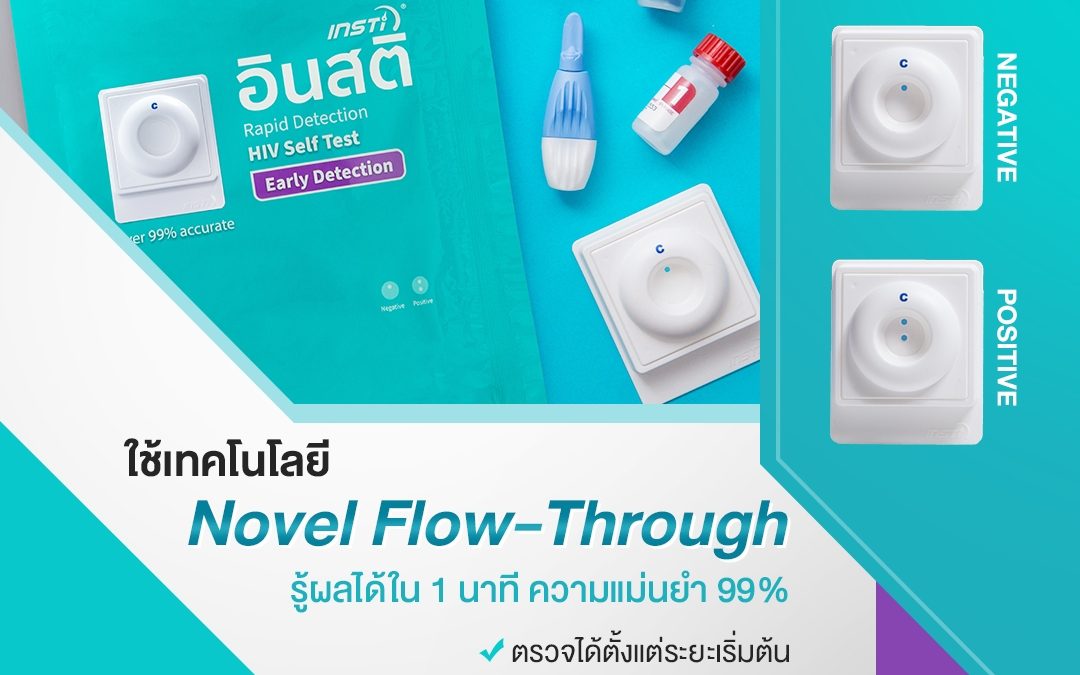 ผลเลือด Positive คืออะไร คำแนะนำหลังจากตรวจหาเชื้อเอชไอวี