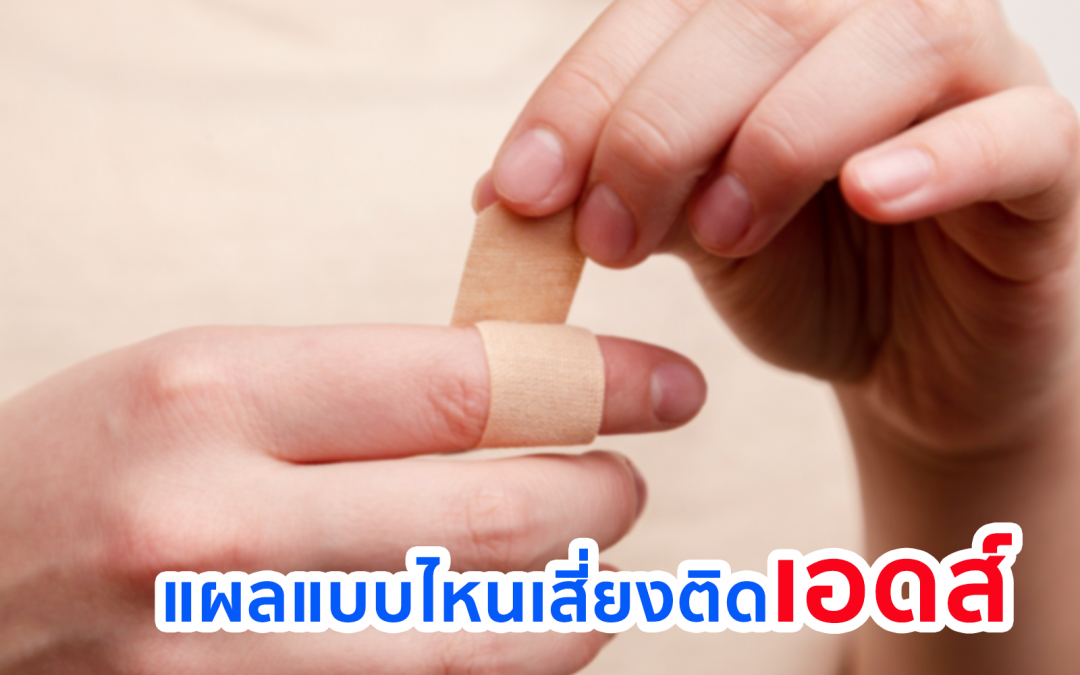 แผลแบบไหนเสี่ยงติดเอดส์ แผลแบบไหนที่อาจทำให้ติดเชื้อHIVได้