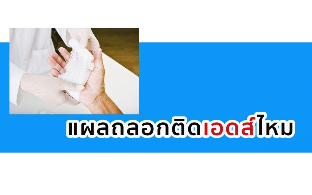 แผลถลอกติดเอดส์ไหม แผลแบบไหนที่อาจทำให้ติดเชื้อได้
